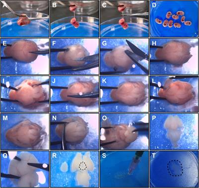 An Efficient Method for the Isolation and Cultivation of Hypothalamic Neural Stem/Progenitor Cells From Mouse Embryos